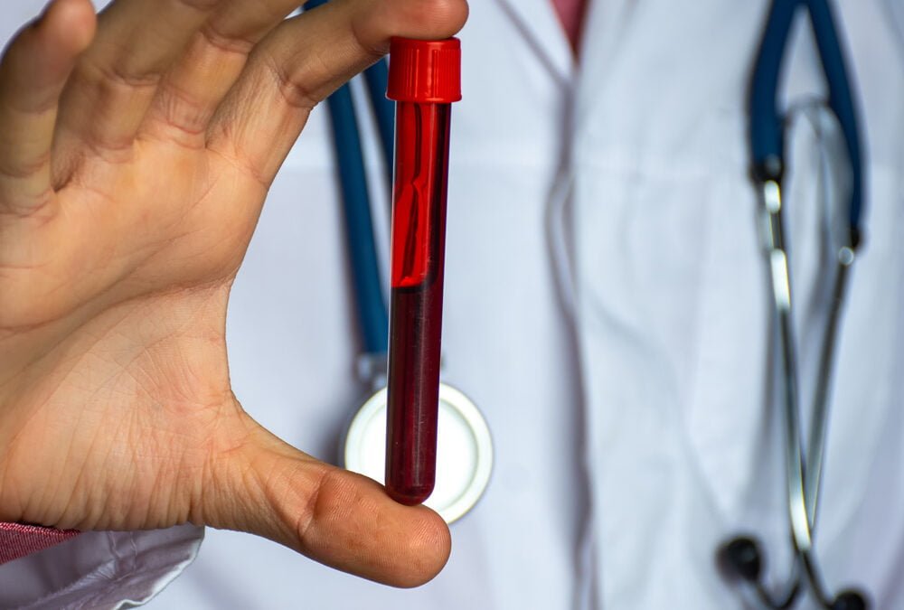 Advanced Functional Medicine Lab Testing