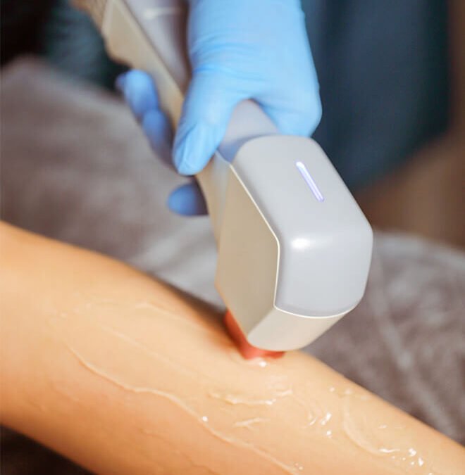 Advanced Laser Hair Removal