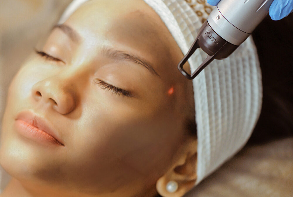 Crystal Carbon Peel Laser
