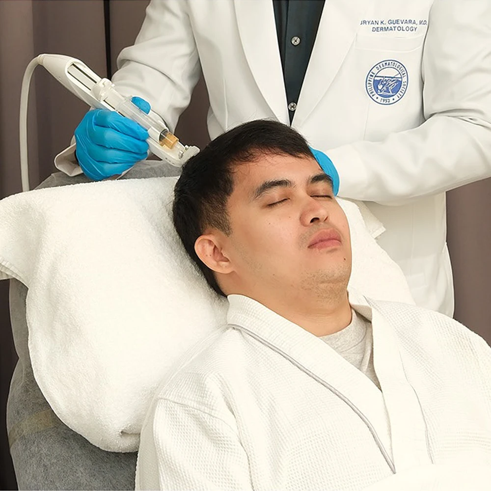 dandruff control treatment